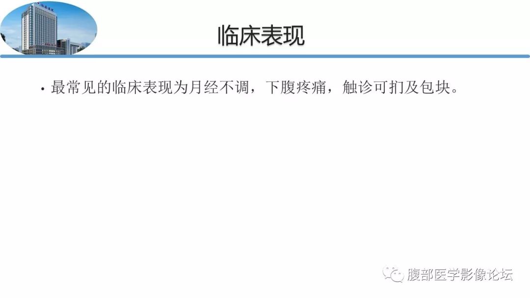 【病例】卵巢硬化性间质瘤1例MR影像诊断