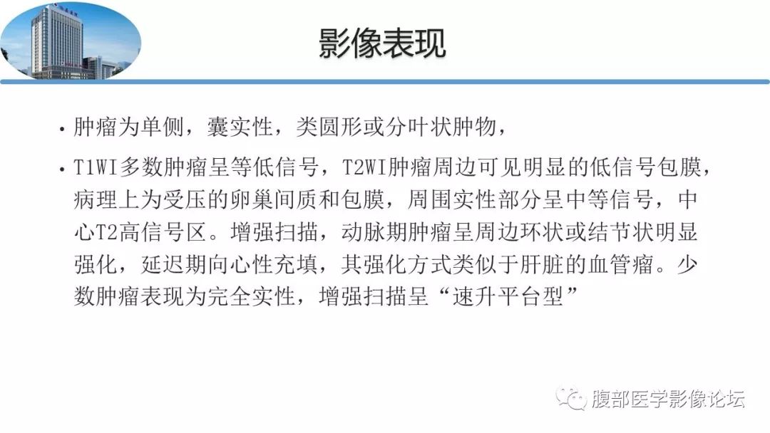 【病例】卵巢硬化性间质瘤1例MR影像诊断