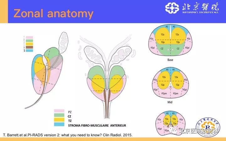 【PPT】男性盆腔常见疾病MR诊断