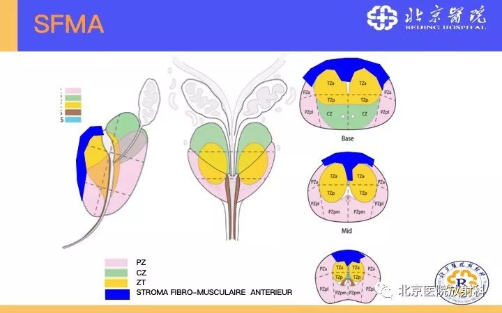 【PPT】男性盆腔常见疾病MR诊断