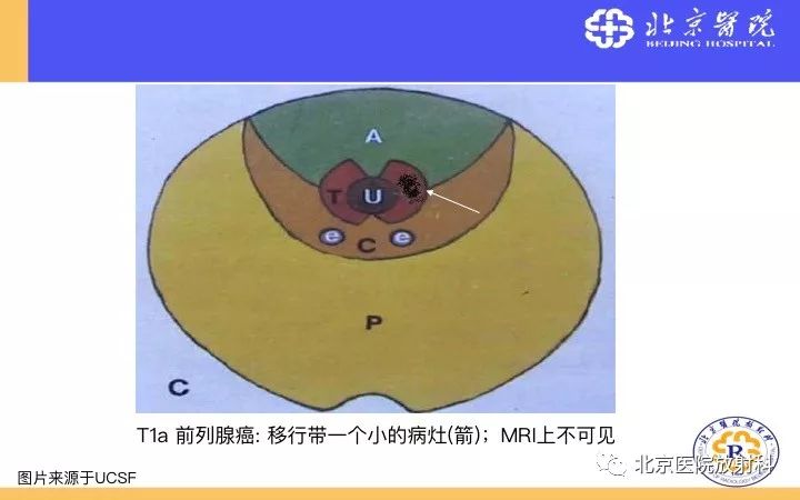【PPT】男性盆腔常见疾病MR诊断