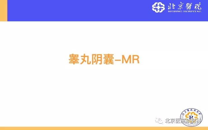 【PPT】男性盆腔常见疾病MR诊断