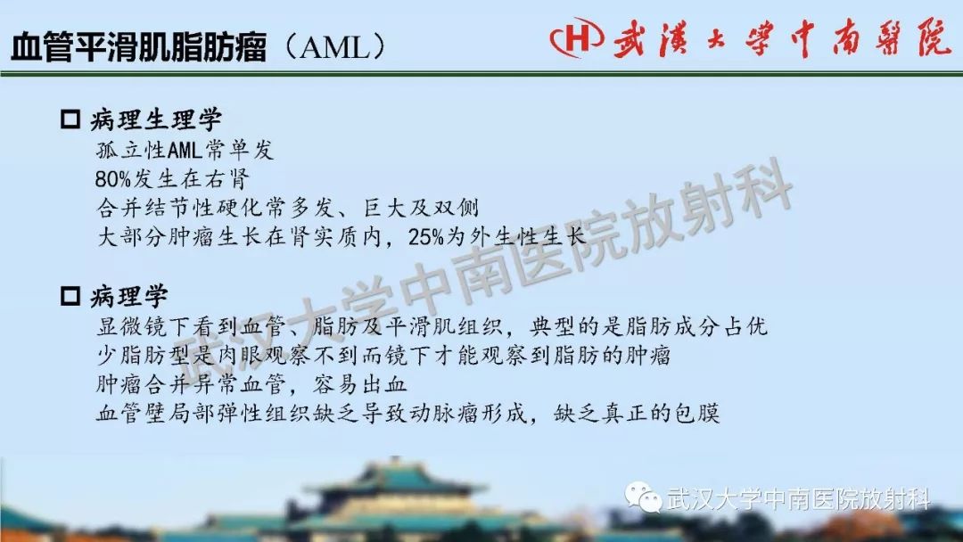 【PPT】肾脏解剖与实性肿瘤