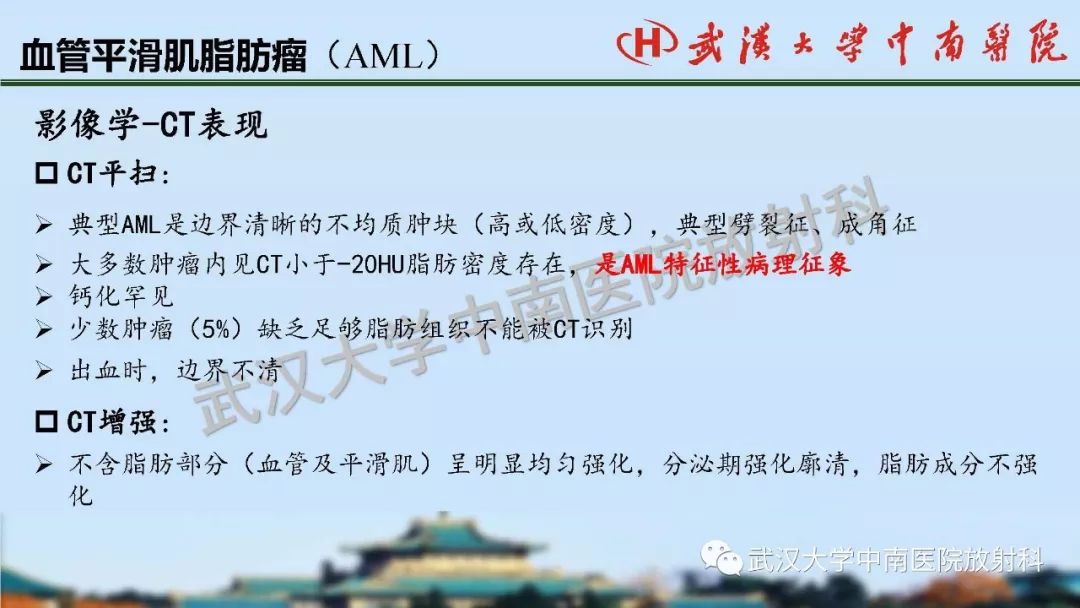 【PPT】肾脏解剖与实性肿瘤