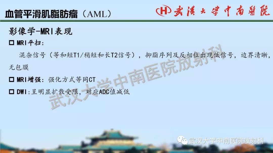 【PPT】肾脏解剖与实性肿瘤