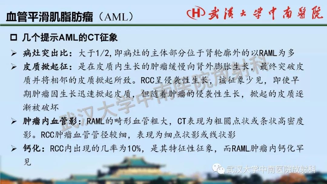 【PPT】肾脏解剖与实性肿瘤