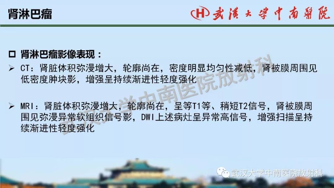 【PPT】肾脏解剖与实性肿瘤
