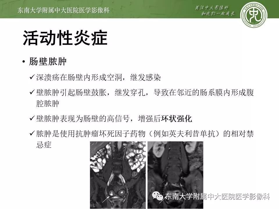 【PPT】炎症性肠病—克罗恩病的MRI表现