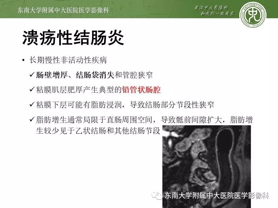 【PPT】炎症性肠病—克罗恩病的MRI表现