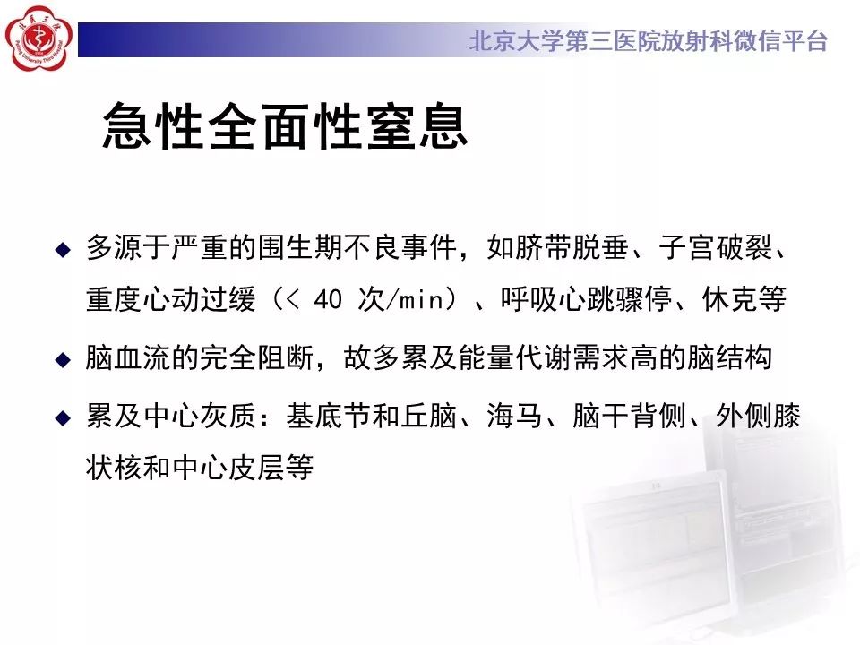 【PPT】新生儿缺氧缺血性脑病HIE的影像