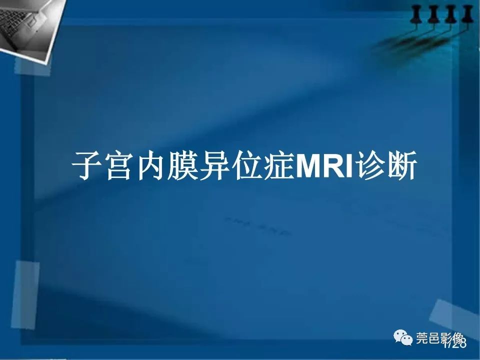 【PPT】子宫内膜异位症MRI诊断