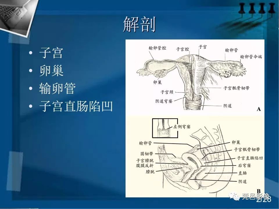 【PPT】子宫内膜异位症MRI诊断