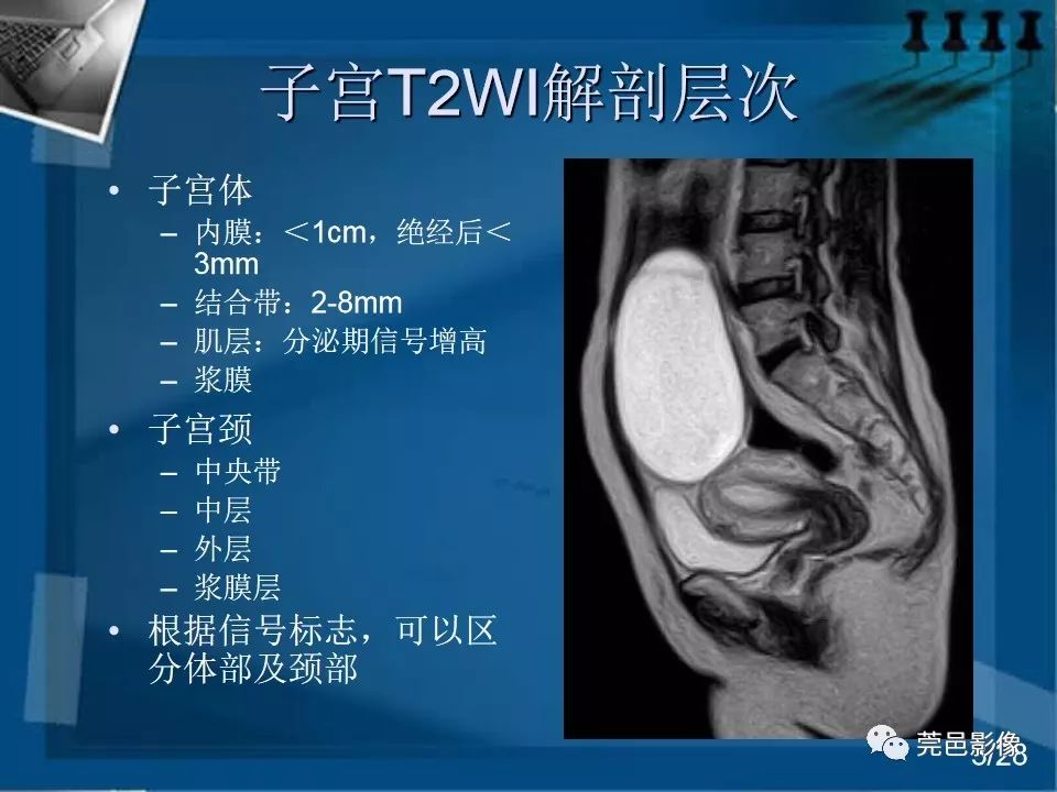 【PPT】子宫内膜异位症MRI诊断