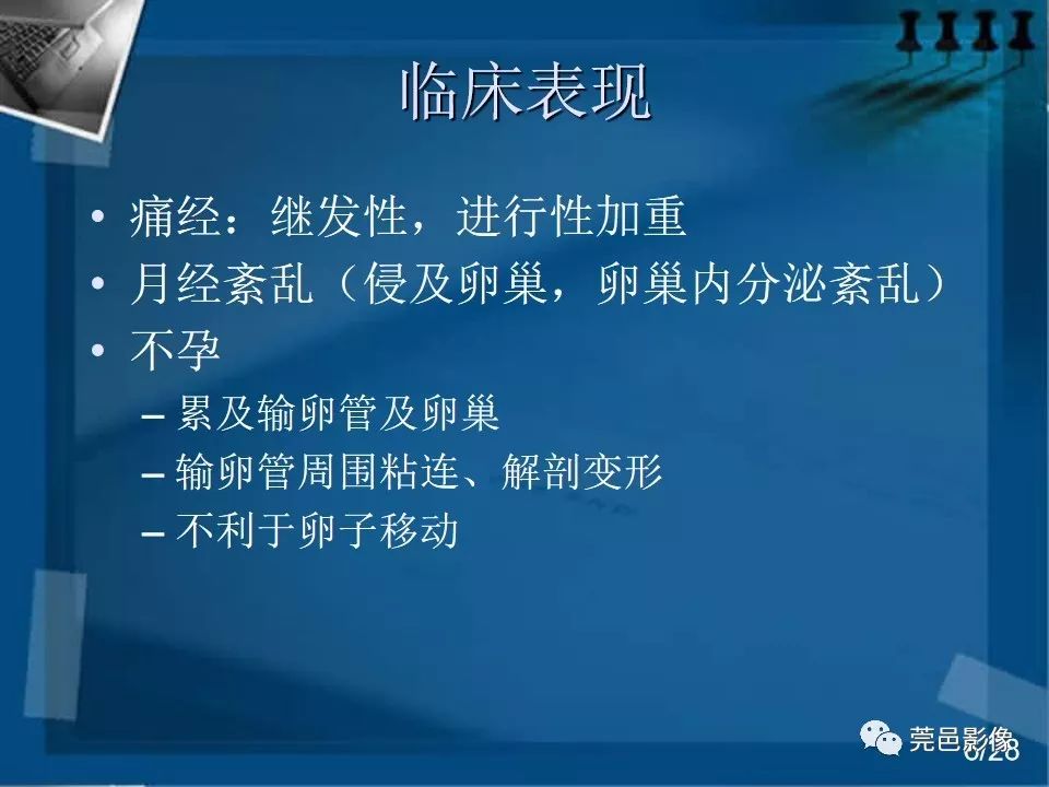 【PPT】子宫内膜异位症MRI诊断