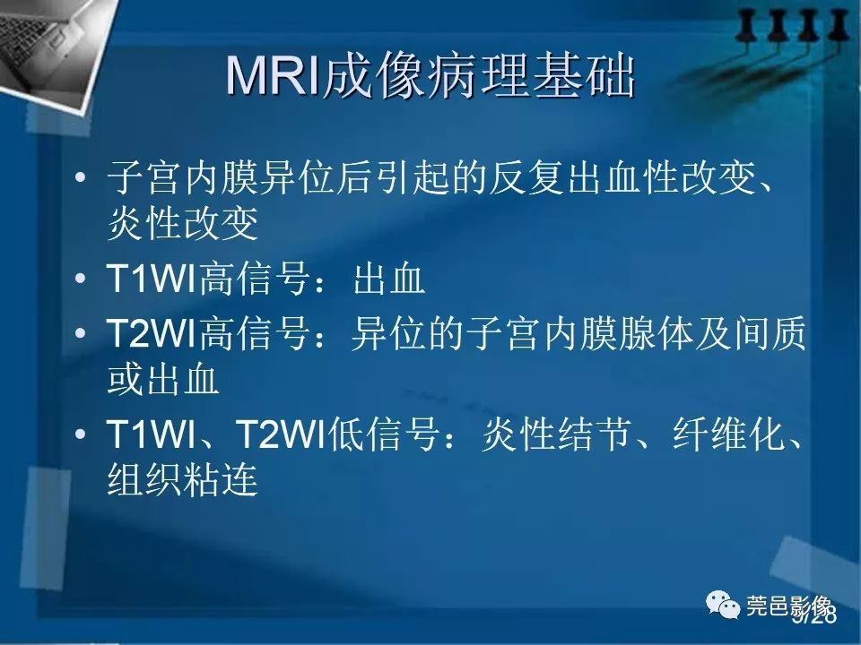 【PPT】子宫内膜异位症MRI诊断