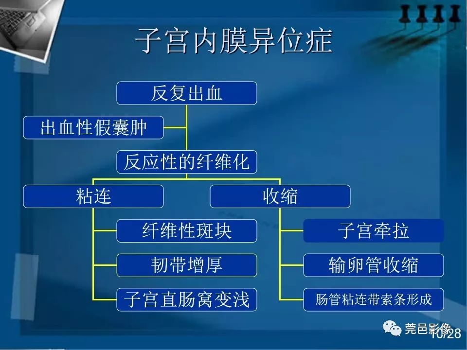 【PPT】子宫内膜异位症MRI诊断