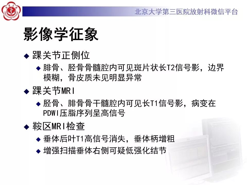 【PPT】ERDHEIM-CHESTER病的影像
