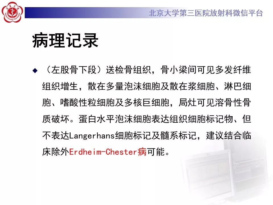 【PPT】ERDHEIM-CHESTER病的影像