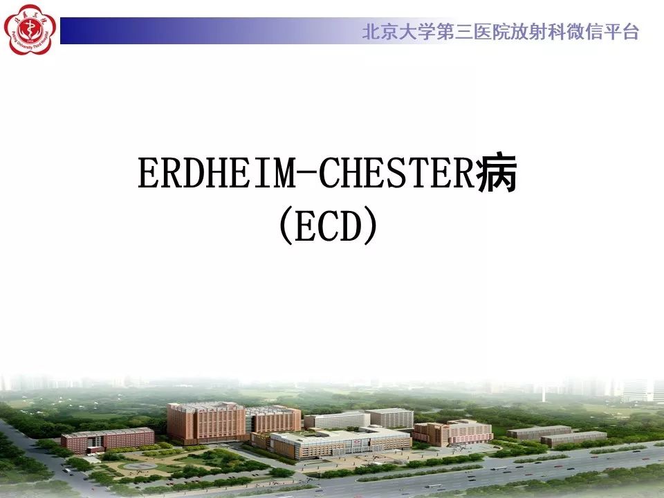 【PPT】ERDHEIM-CHESTER病的影像
