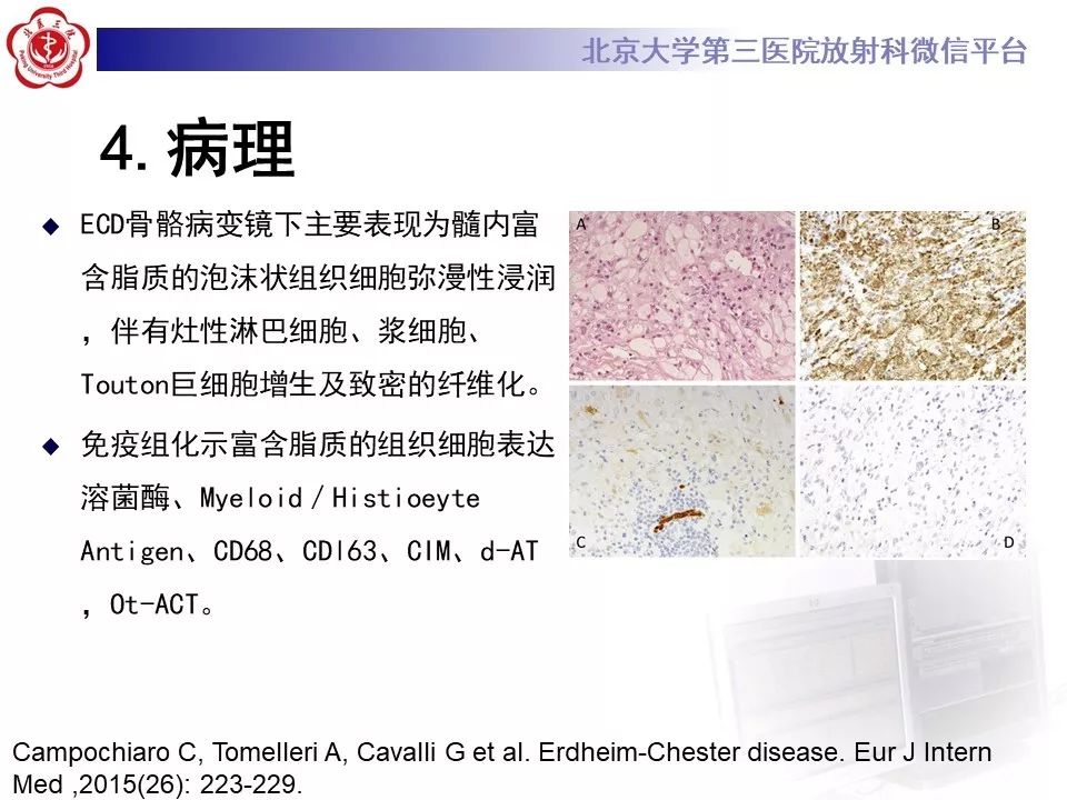 【PPT】ERDHEIM-CHESTER病的影像