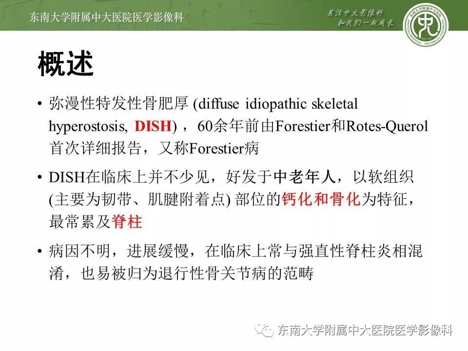 【PPT】弥漫性特发性骨肥厚