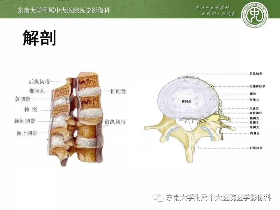 【PPT】弥漫性特发性骨肥厚