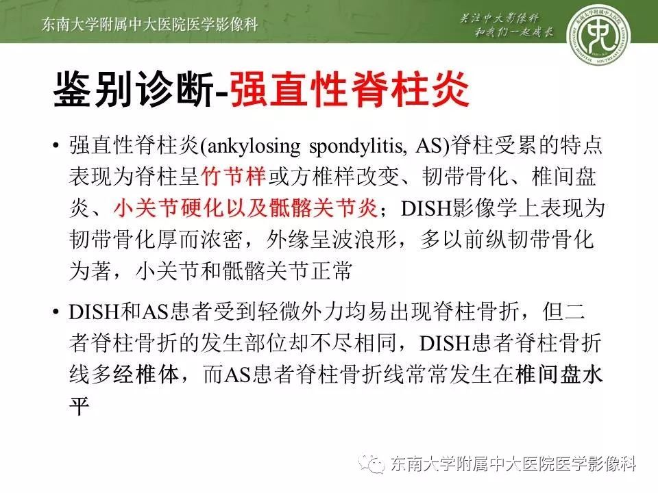【PPT】弥漫性特发性骨肥厚