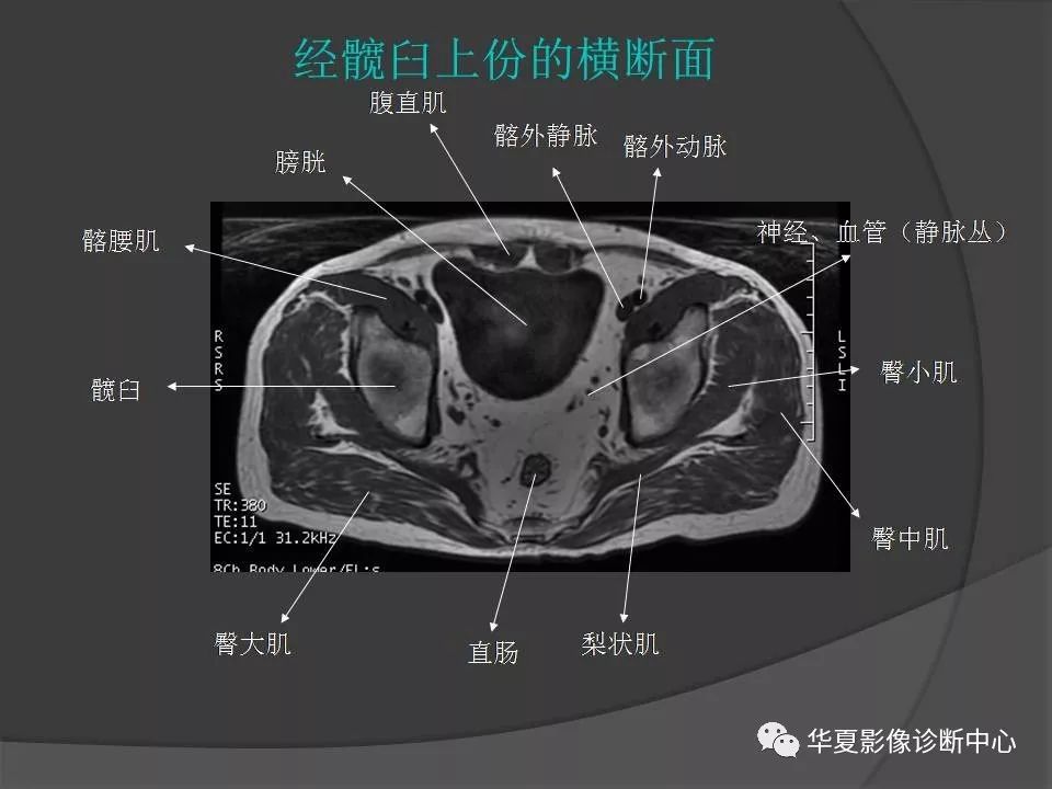 【PPT】骨盆肌肉解剖MRI标识