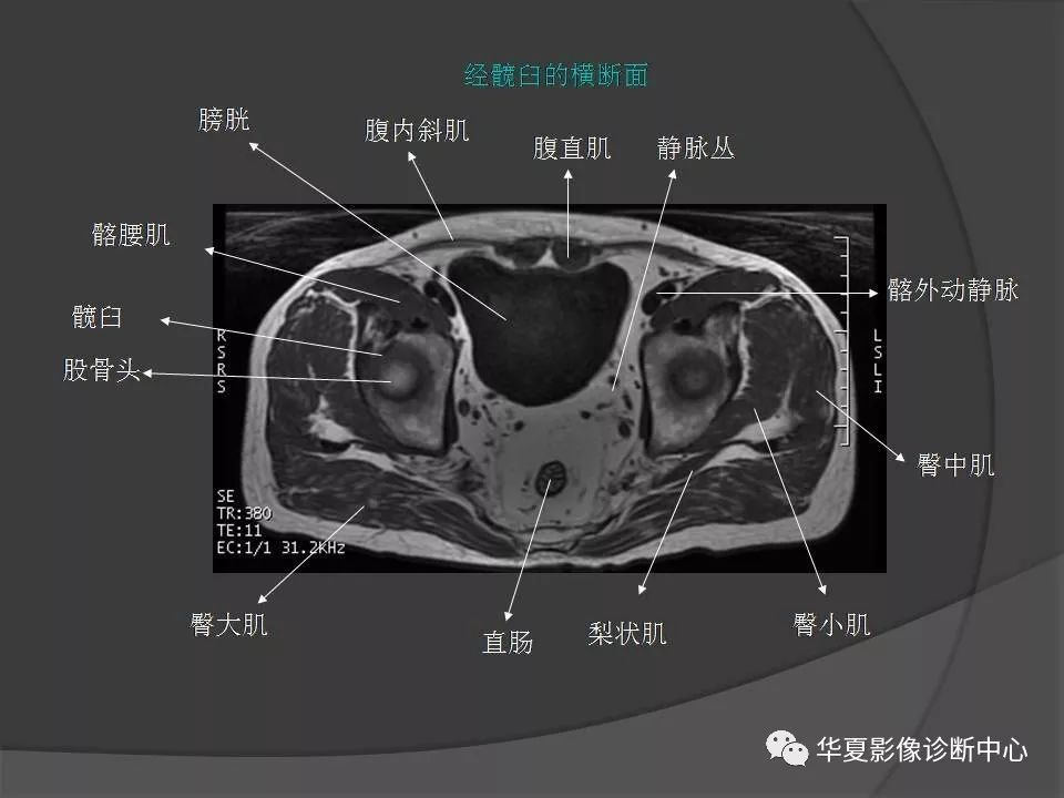 【PPT】骨盆肌肉解剖MRI标识