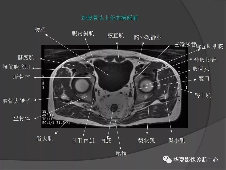 【PPT】骨盆肌肉解剖MRI标识