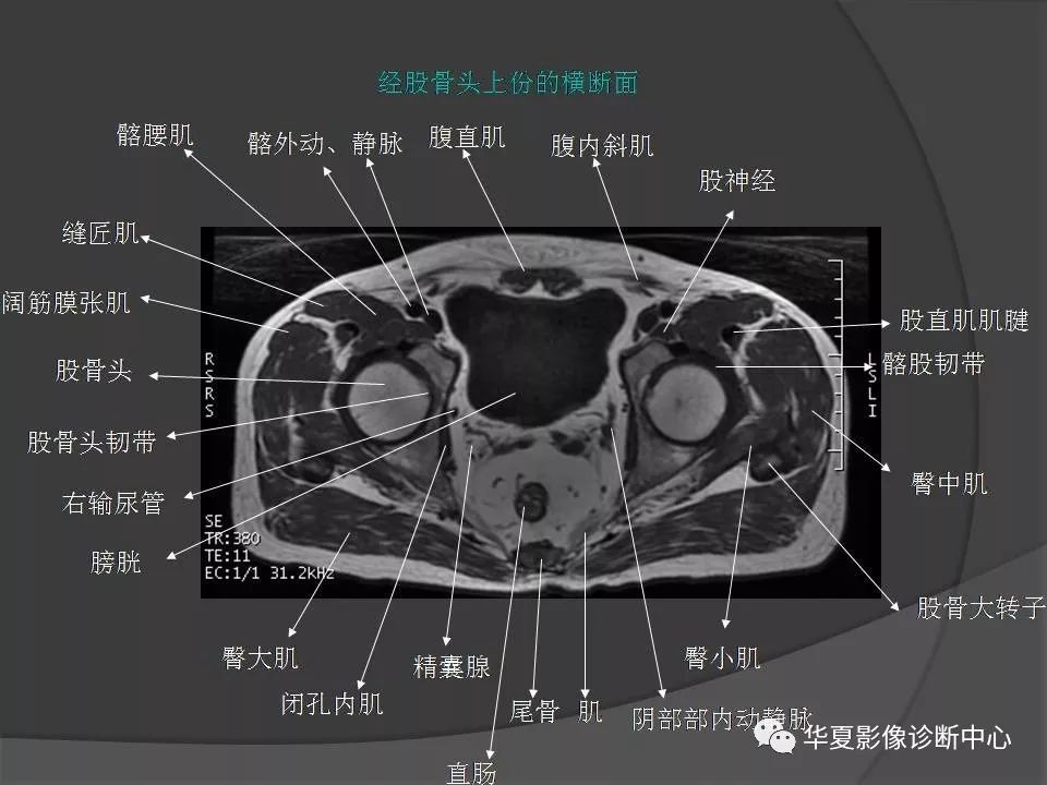 【PPT】骨盆肌肉解剖MRI标识