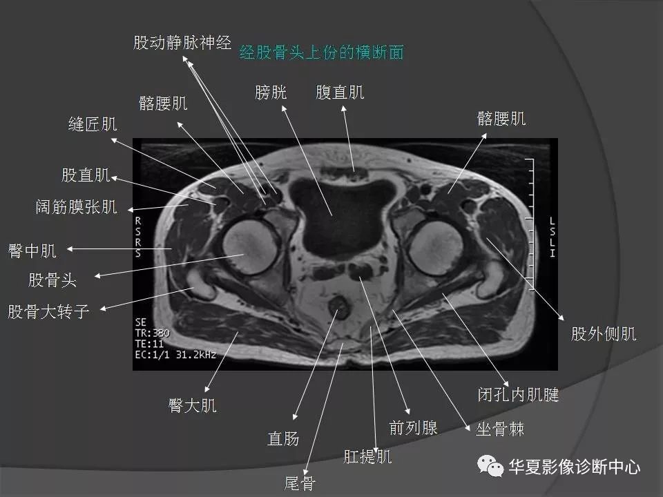 【PPT】骨盆肌肉解剖MRI标识