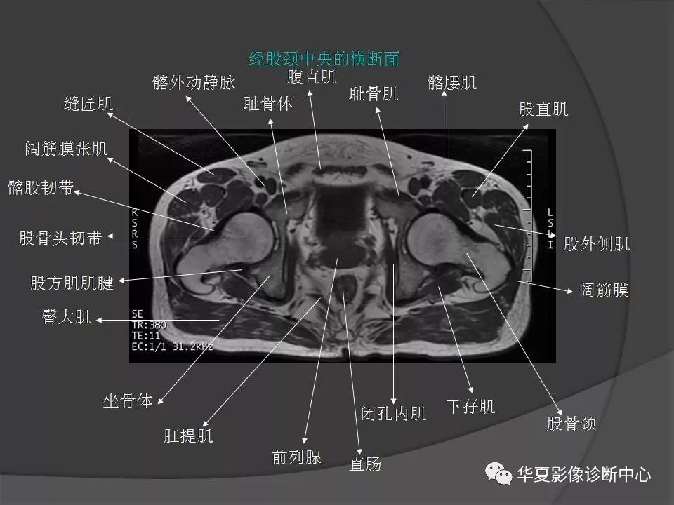 【PPT】骨盆肌肉解剖MRI标识