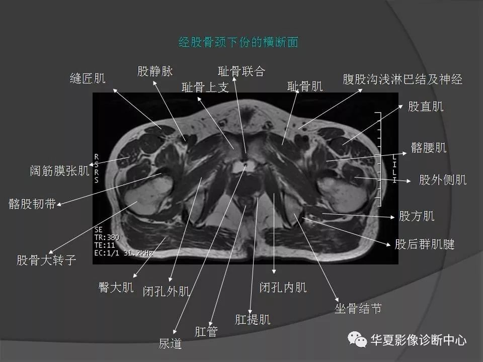 【PPT】骨盆肌肉解剖MRI标识