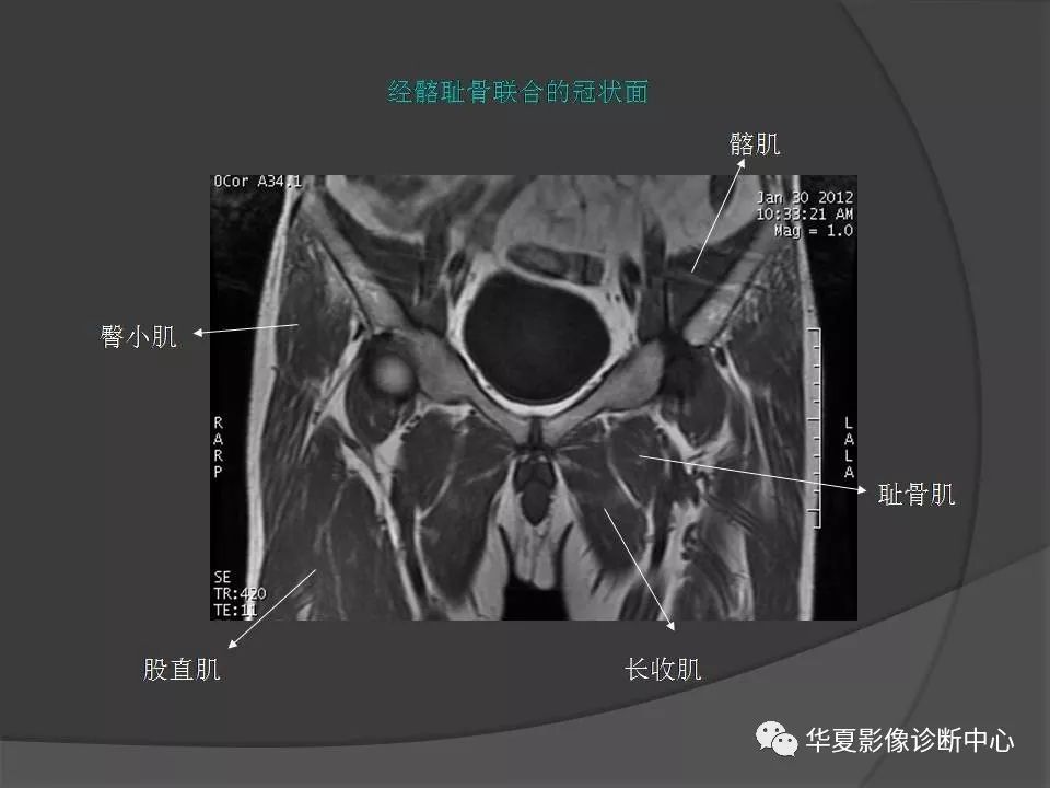【PPT】骨盆肌肉解剖MRI标识