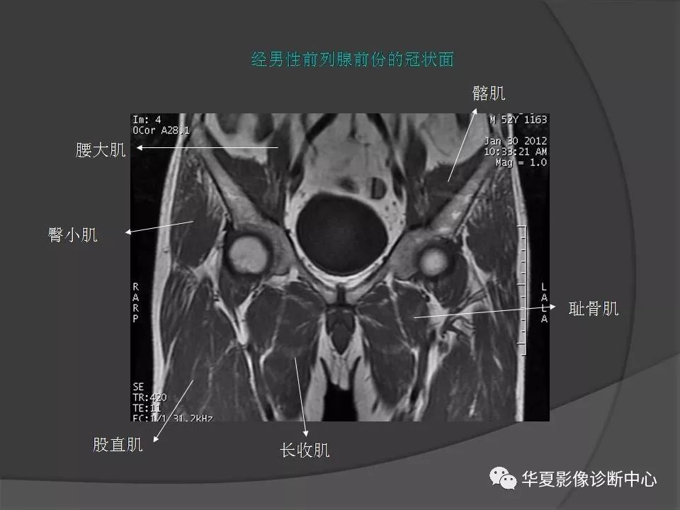 【PPT】骨盆肌肉解剖MRI标识