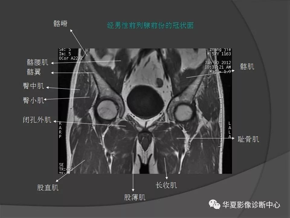 【PPT】骨盆肌肉解剖MRI标识