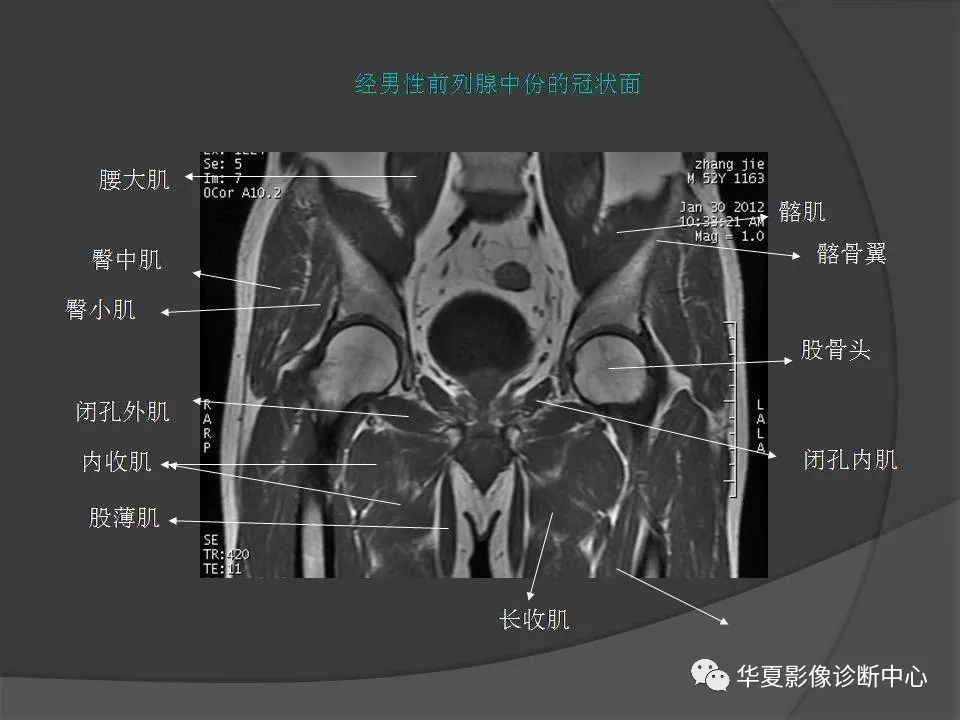 【PPT】骨盆肌肉解剖MRI标识