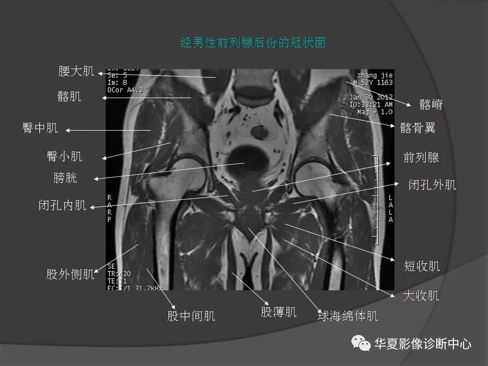 【PPT】骨盆肌肉解剖MRI标识