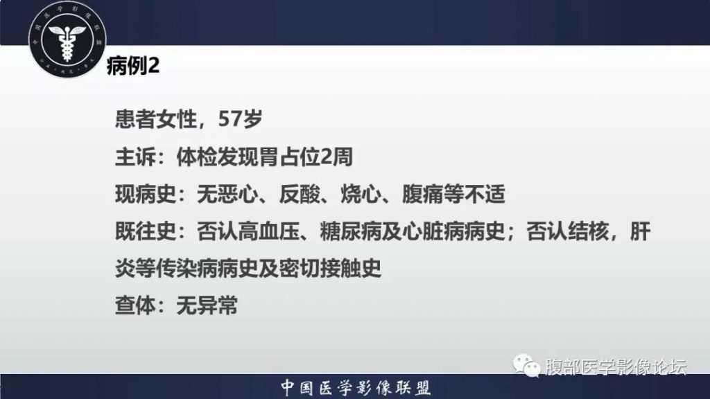 【病例】胃癌1例CT影像