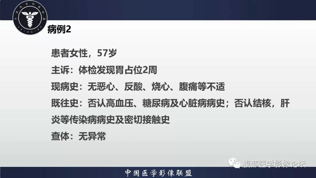 【病例】胃癌1例CT影像