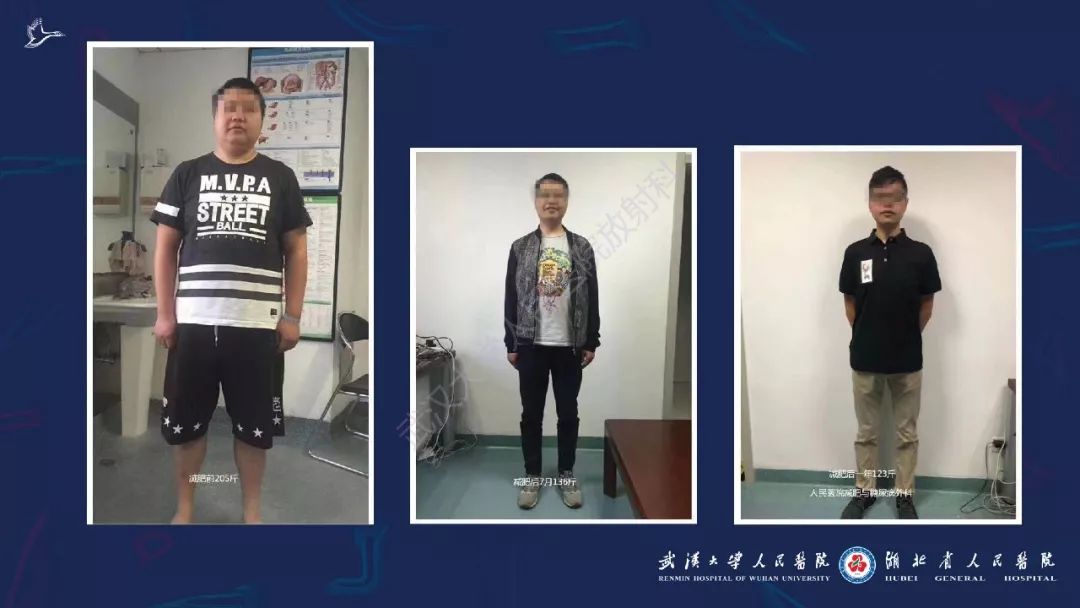 【PPT】减重术后正常表现及并发症影像诊断