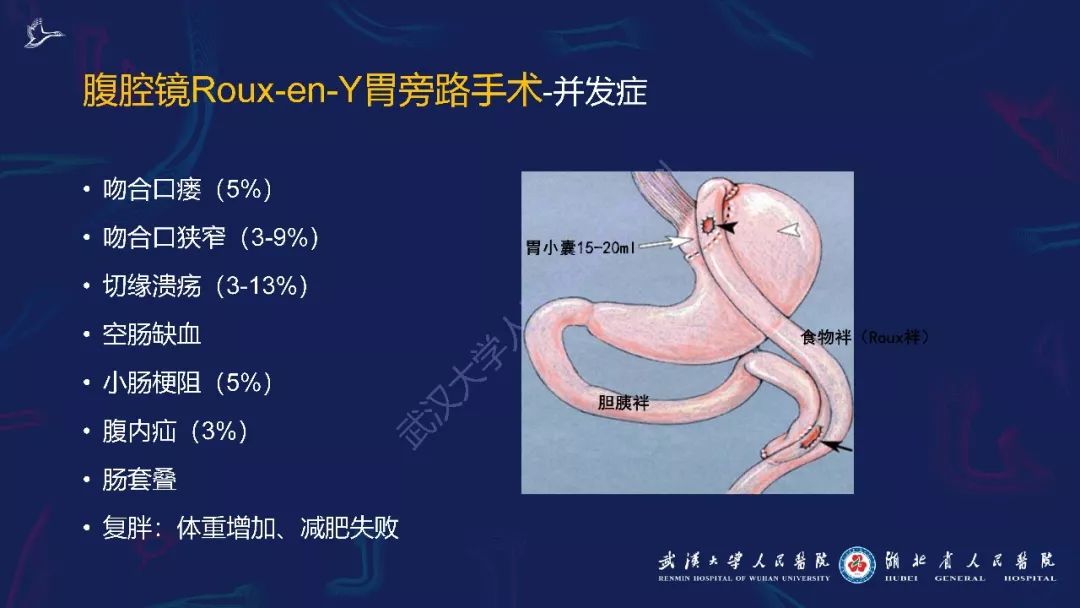 【PPT】减重术后正常表现及并发症影像诊断