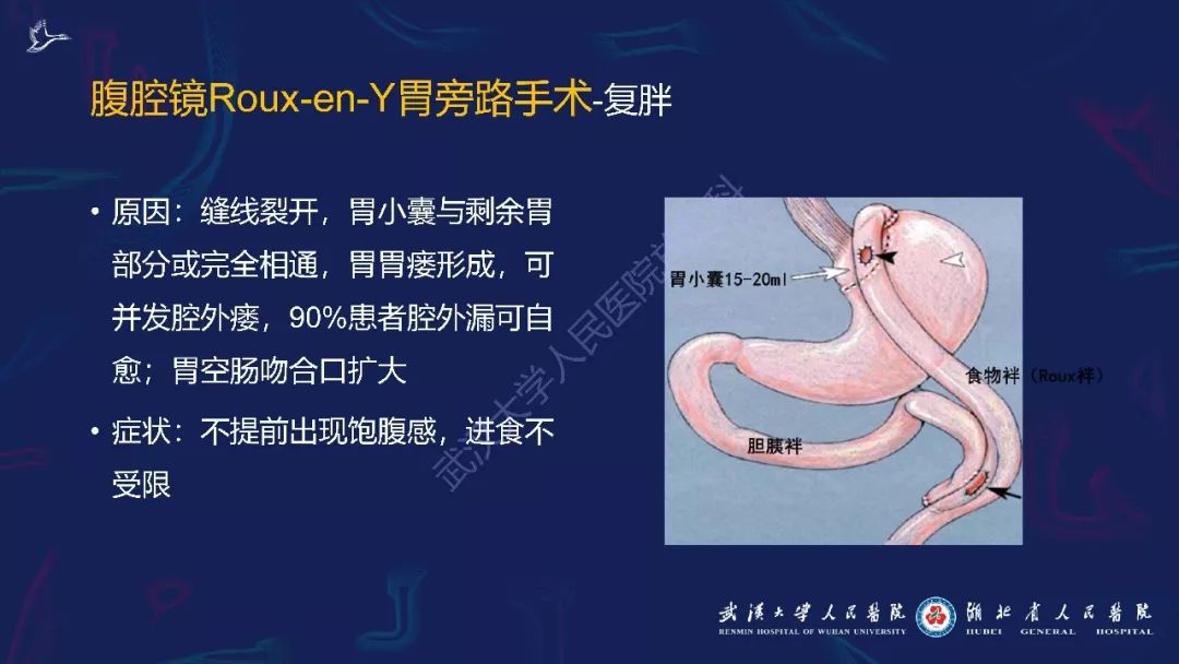 【PPT】减重术后正常表现及并发症影像诊断