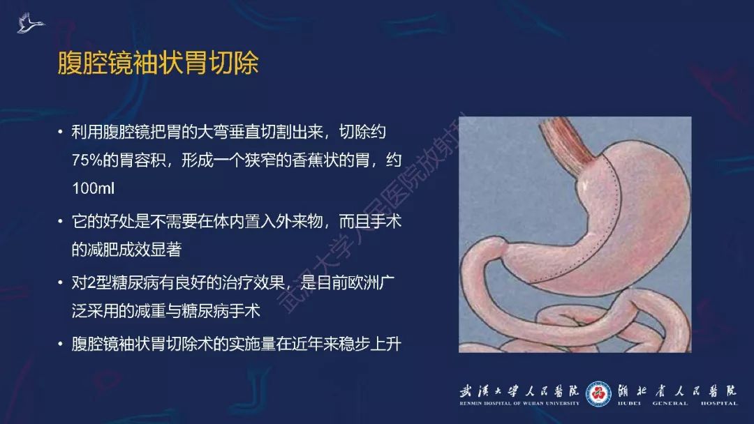 【PPT】减重术后正常表现及并发症影像诊断