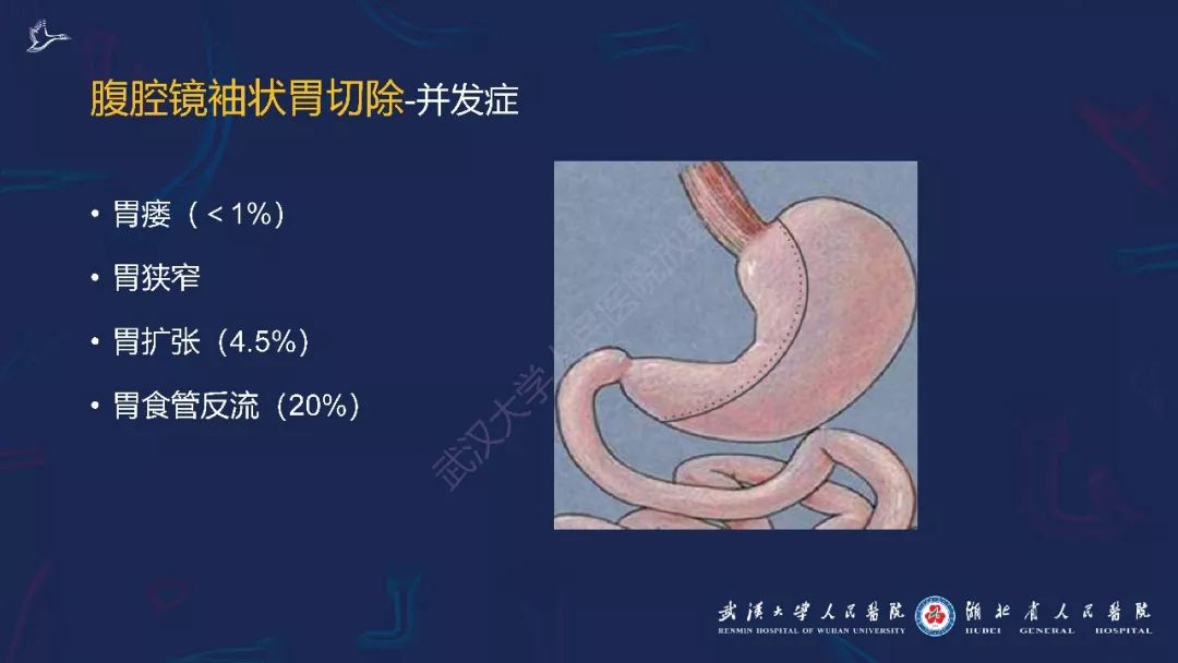 【PPT】减重术后正常表现及并发症影像诊断