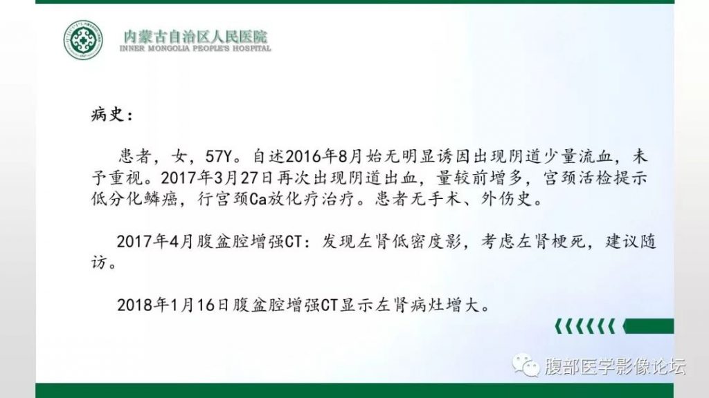 【病例】左肾子宫内膜异位囊肿1例CT及MR