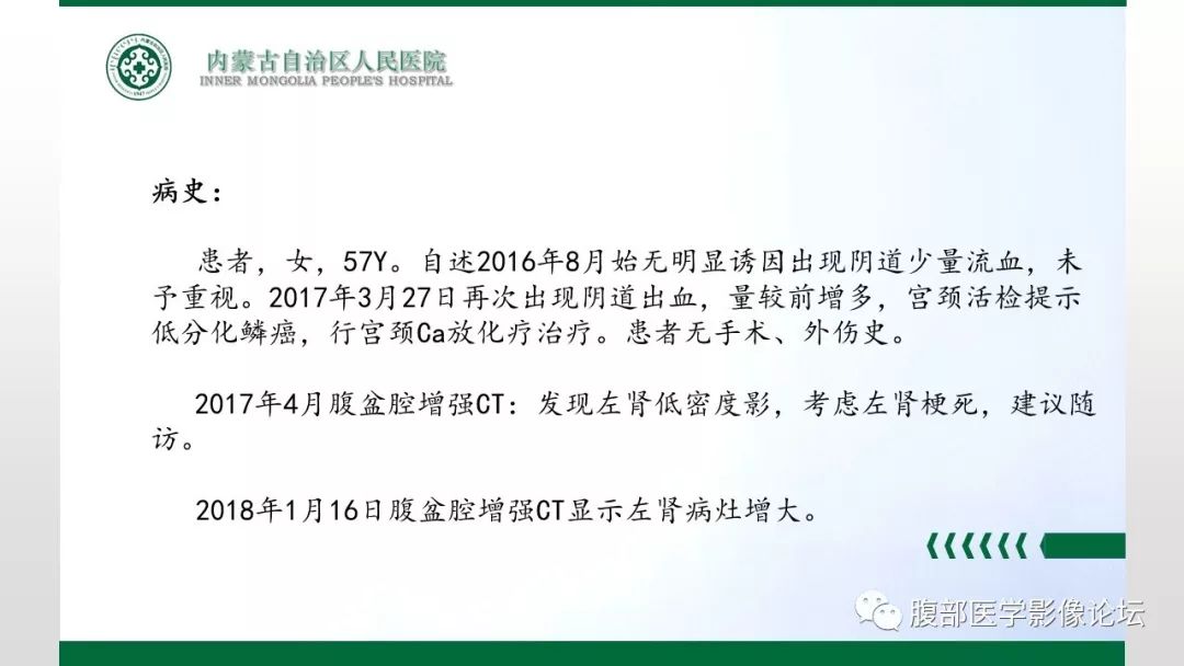 【病例】左肾子宫内膜异位囊肿1例CT及MR