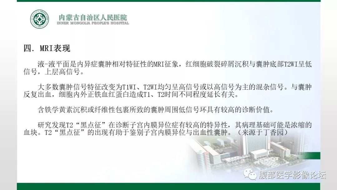 【病例】左肾子宫内膜异位囊肿1例CT及MR