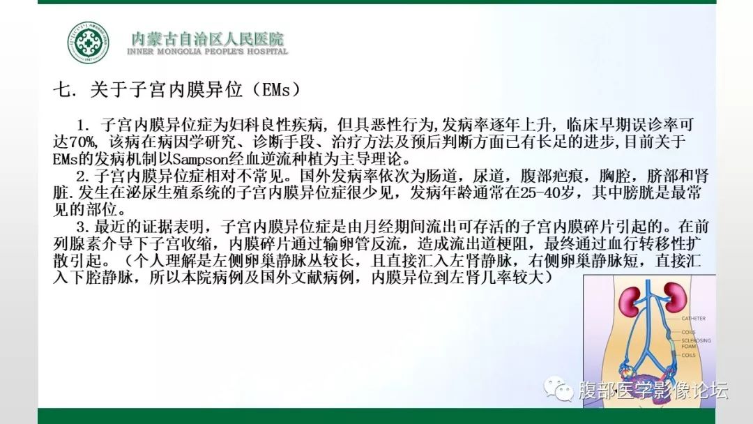 【病例】左肾子宫内膜异位囊肿1例CT及MR